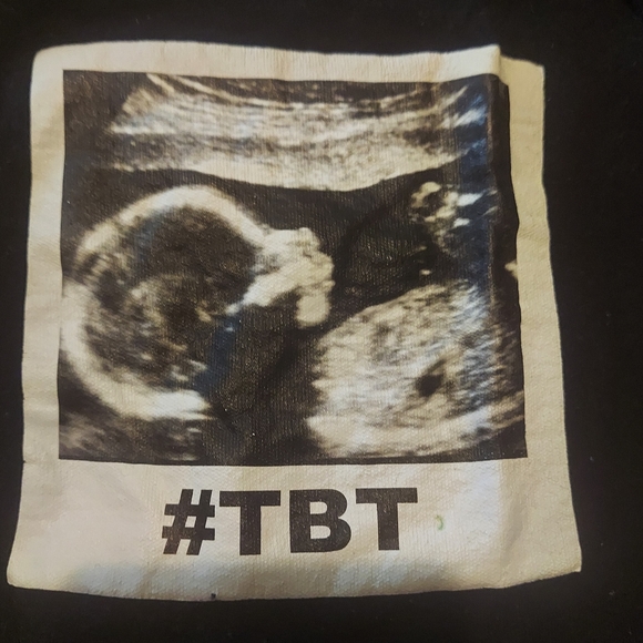 #TBT ONSIE - Picture 2 of 3